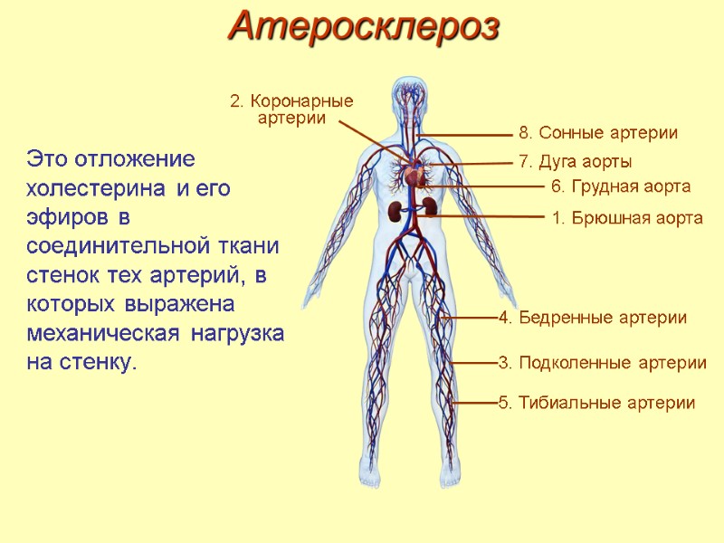 Это отложение холестерина и его эфиров в соединительной ткани стенок тех артерий, в которых